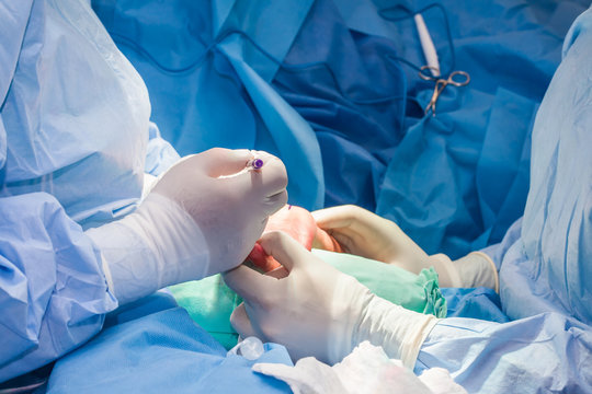 हाताची शस्त्रक्रिया (Hand Surgery)